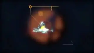 MoonScoop 