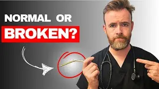 What I Tell Men About Erections After 40
