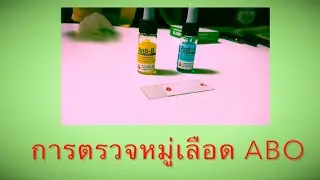 การตรวจหมู่เลือด ABO