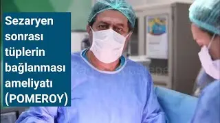 Tüpler nasıl bağlanır? Sezaryen sonrası Pomeroy Fallop tüp ligasyonu ile gebelikten kalıcı korunma
