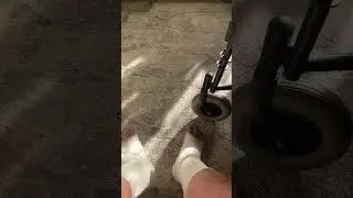 Как мне сняли гипсы