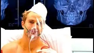 Sage Northcutt vs Cosmo Alexandre (Facial bone fracture!)