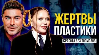 ЖЕРТВЫ ПЛАСТИКИ. 17 ЗВЕЗД, КТО НЕ СМОГ ОСТАНОВИТЬСЯ ВОВРЕМЯ