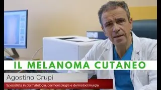 Agostino Crupi - Che cos'è il Melanoma Cutaneo?