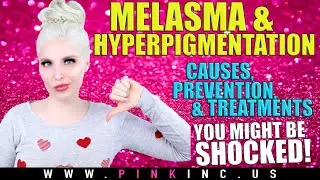 Melasma & Hyperpigmentation | Causes, Prevention, & Treatments | You Might Be Shocked! Tanya Feifel