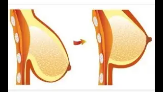 Secrets of Olive Oil | Why olive oil is best for Women and skin care