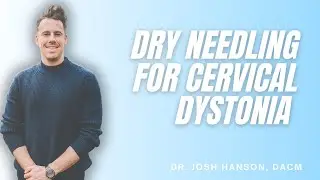 Dry Needling for Cervical Dystonia - Everything You Wanted to Know