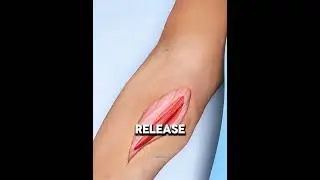 Why Do MotoGP Riders Have This Scar? 😳 