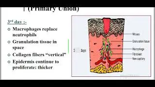 Repair 2  pathology