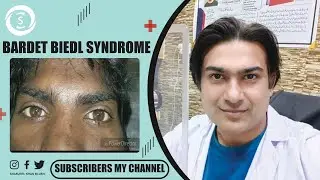 Bardet biedl syndrome