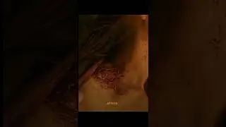 Tess gets infected! 