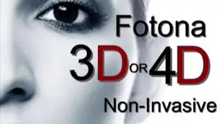 Fotona 4D SmoothEye Liplase