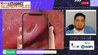Cuidado con esto en tu lengua puede ser bastante malo