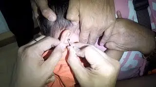 Removing Crying Boy's Earwax Using Cotton Bud Ear Scoop
