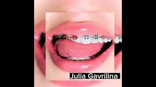 Юля Гаврилина "Брекиты"(Премьера)