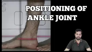HOW TO DO X-RAY OF ANKLE JOINT. #xrayclasses #anatomy #ankle .