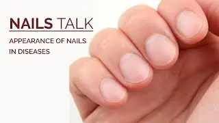 How Do Nails Help in Diagnosing Systemic Disease ? Nail Abnormalities in Systemic Diseases