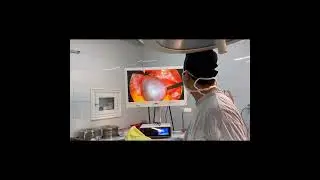 Чап тухумдон кистаси!