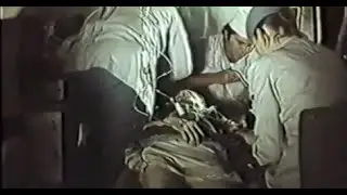 Оказание неотложной помощи при травмах. СССР.