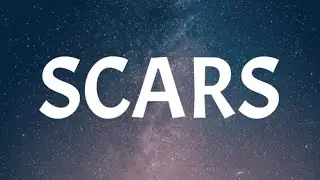 1nonly - Scars (Lyrics)