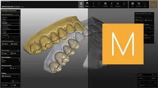 Uploading a wax-up in Zirkonzahn.Modellier | Zirkonzahn.Software