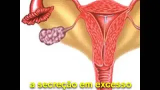Paródia de O Rei do Gado - Sicose (Homeopatia)