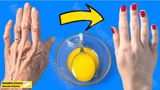 Quitar Arrugas En Las Manos Rápidamente Con Esta Mezcla! Y Obtener Manos Suaves