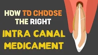 Intra canal medicaments