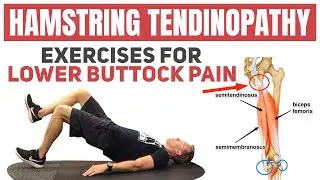How To Alleviate Upper Hamstring Pain