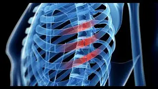 Chest Trauma