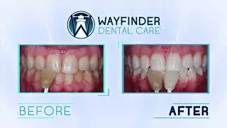 Custom Content Example: Dental Before & After