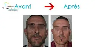 La Chirurgie Plastique , esthétique, et Réparatriceavec Docteur Madjoudj.