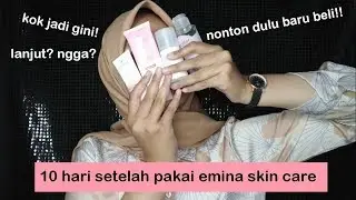 PART 2 || REVIEW EMINA BRIGHT STUFF SETELAH 10 HARI PEMAKAIAN RUTIN