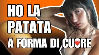 HO LA PATATA A FORMA DI CUORE ❤