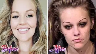 Shocking Before and After Drug Use Photos