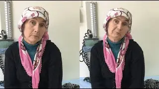 Prof. Dr. Tanju Uçar - Oromandibular Distoni Hastası - Ameliyat Sonrası