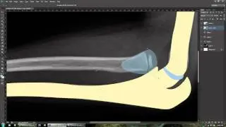 Behind the scenes - medical illustration