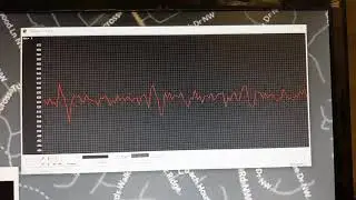 UCR on the Arduino Uno scope.