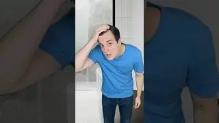 I think I'm going bald #comedy #music #balding #hairloss #musicalcomedy