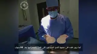 Dr.Mohan Rangaswamy speaks from the operating theater while he is doing explantation surgery