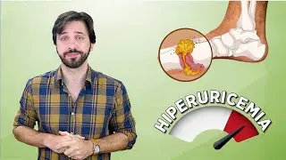 GOTA - Sintomas, Dieta e Tratamento