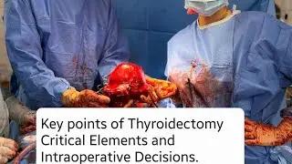 Key points of Thyroidectomy  Critical Elements and Intraoperative Decisions. Part 2