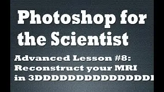 Recontruct your MRI in 3D using Photoshop CC