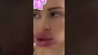 Тик Ток:Накачала губёшки😂
