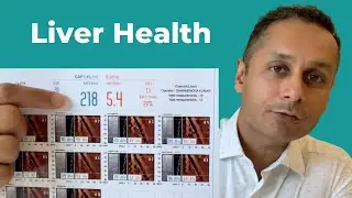 Fatty Liver | Non-alcoholic Fatty Liver Disease | How to Reverse | Fasting | Keto