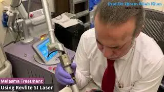Melasma Transformation You WON'T BELIEVE! Revlite SI Laser #lasertherapy #melasma