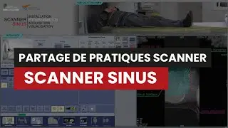 CT SCANNER SINUS - Partage de pratiques