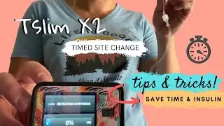 T:slim X2 Timed Site Change | Tips & Tricks with Using The Pump & Control IQ System