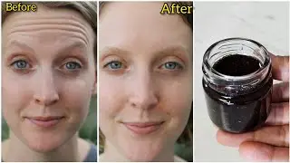 Facelift with natural collagen! This oil will make all wrinkles on your face disappear