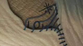 Silence of the Lambs   Procedural Stitching System